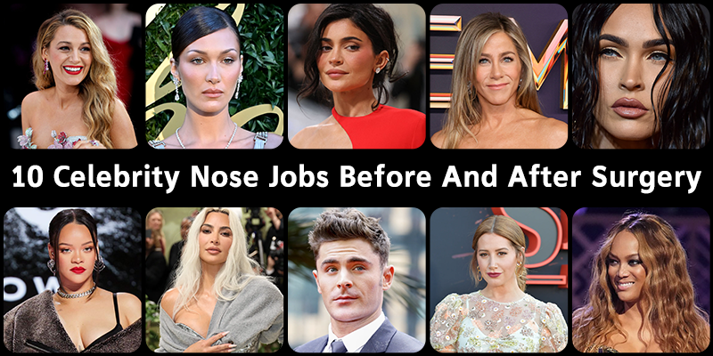 Celebrity Nose Jobs